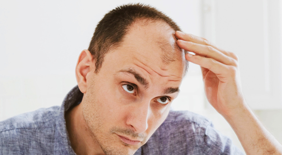 Male hair loss treatment in farnham common