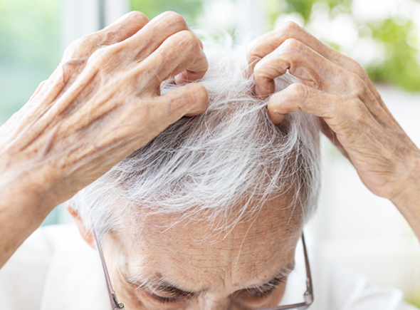 Effective treatment for scalp inflammation in taplow