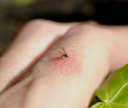 Infected insect bite treatment in Slough