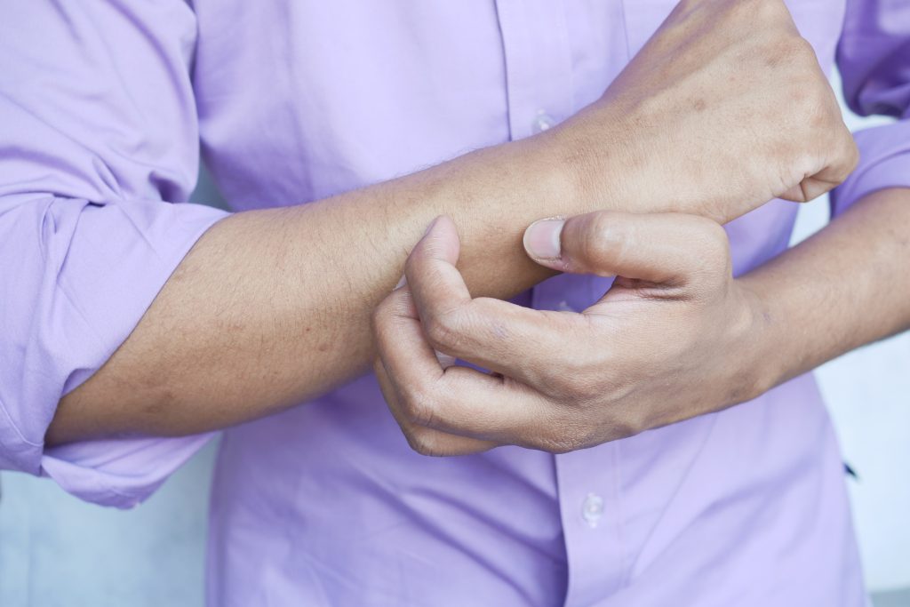 Prevent Insect Bites