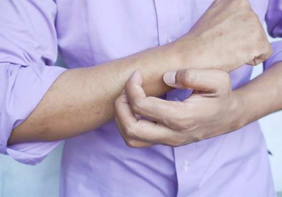 Prevent Insect Bites
