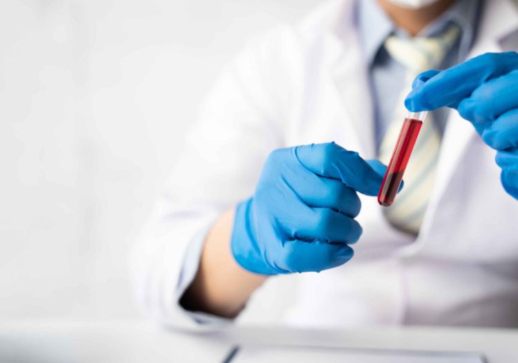 Private blood test in Farnham Royal