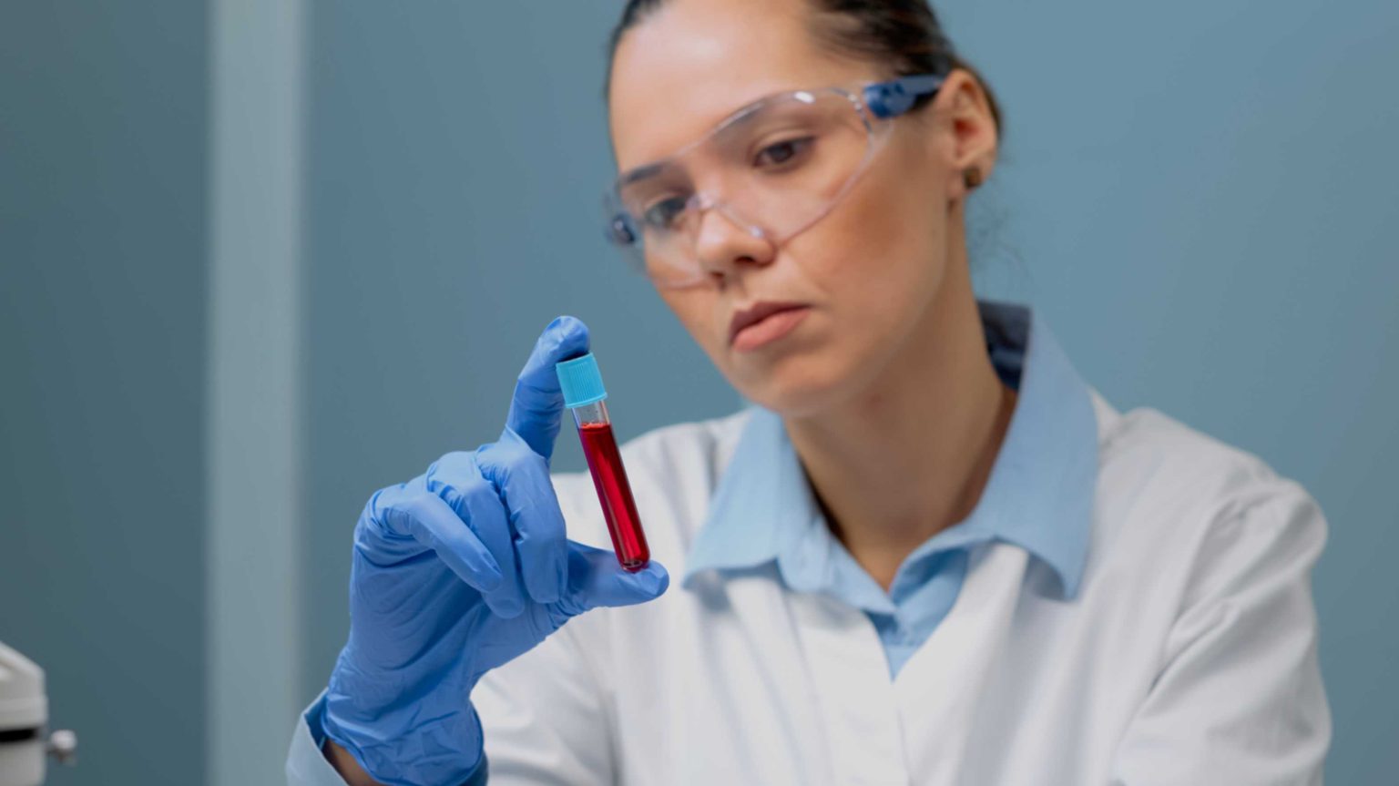 Blood Test for Vitamin Deficiency: Complete Guide - Aroga Pharmacy
