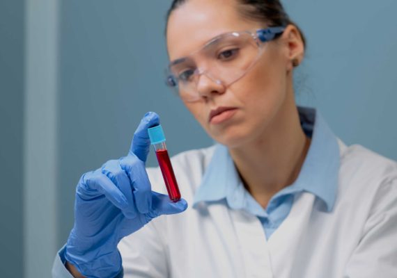 Blood test for vitamin deficiency