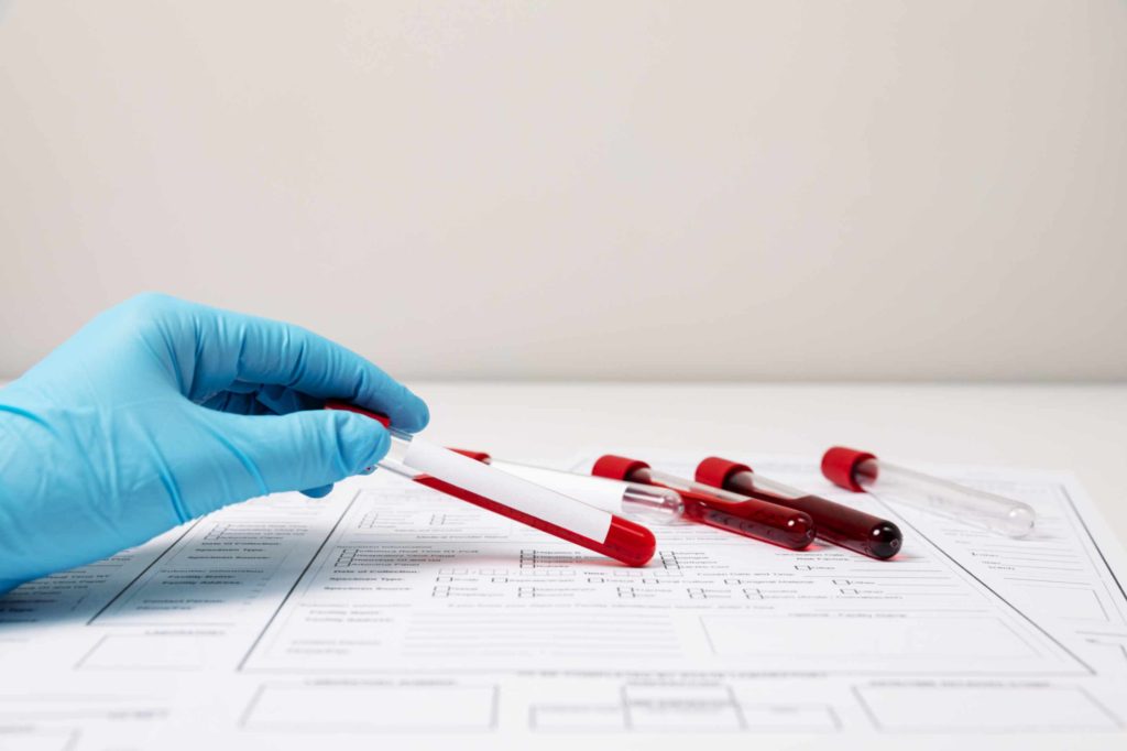 Private blood test cost 
