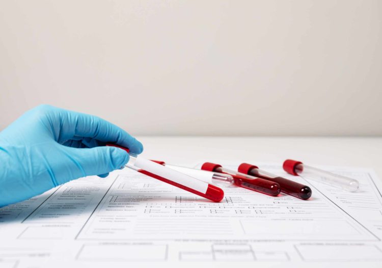 Private blood test cost