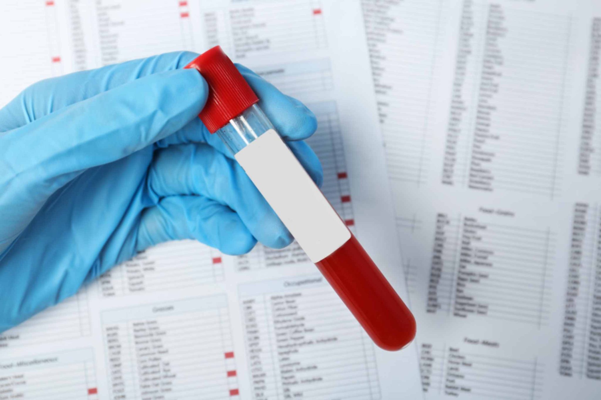 Thyroid Blood Test: Everything You Need to Know - Aroga Pharmacy