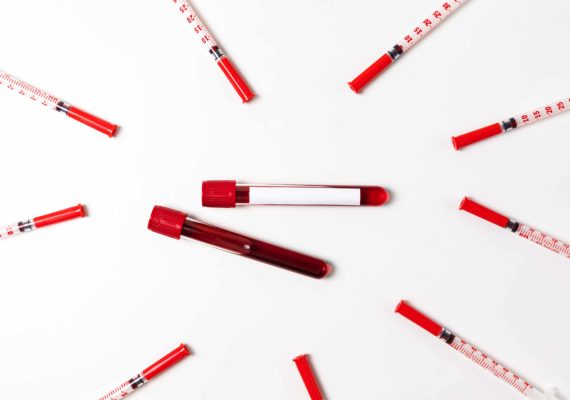 Tumour marker blood test for early cancer detection