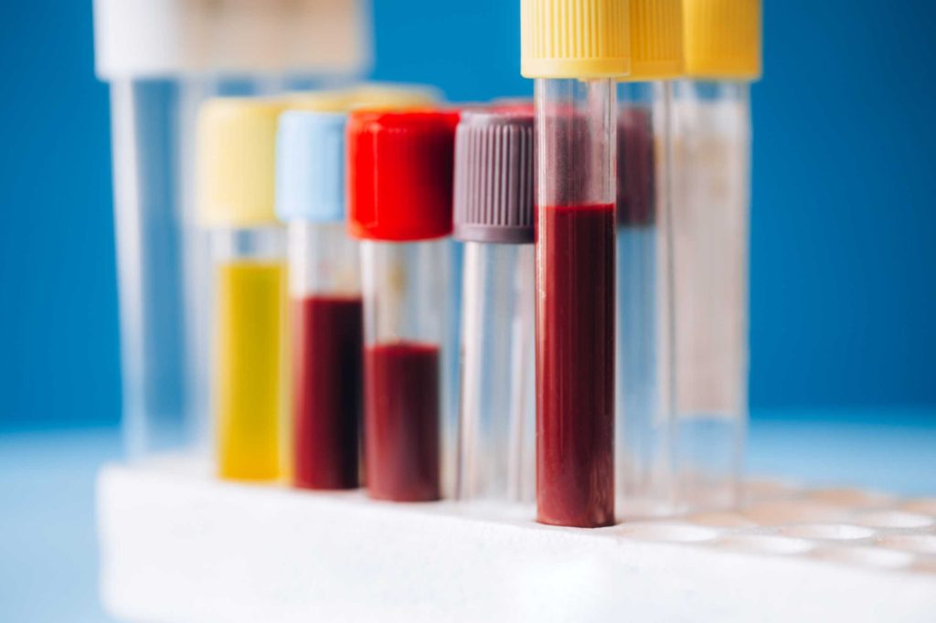 Blood Tests Should You Have in Your 40s