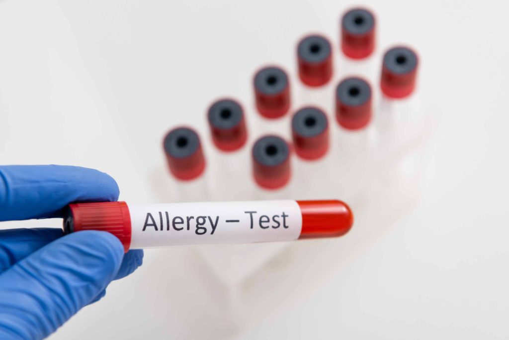 Allergy Blood Tests UK: Identify Food & Environmental Triggers