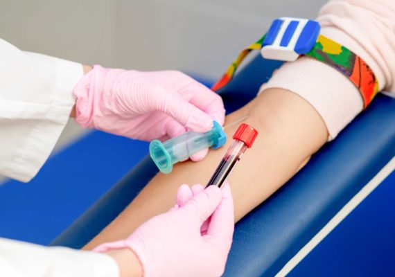 Blood Tests for Energy, Immunity & Vitamin Deficiency