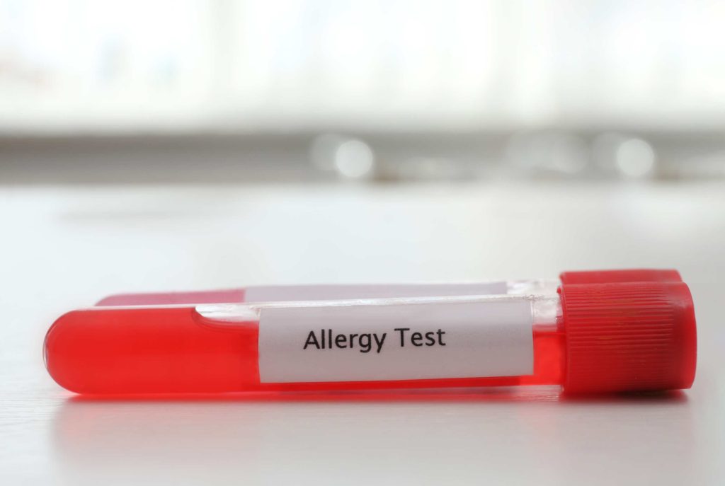 Food Allergy Blood Test