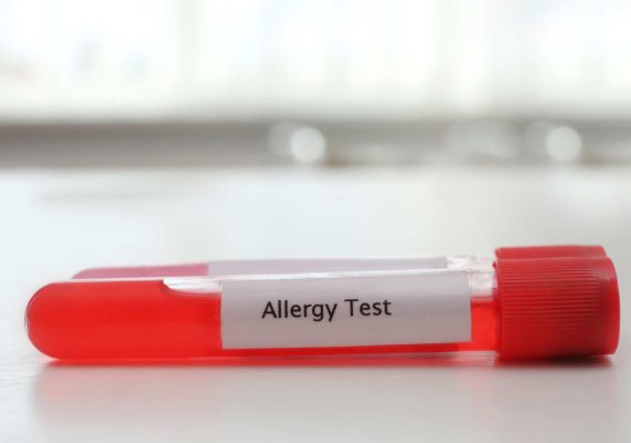 Food Allergy Blood Test