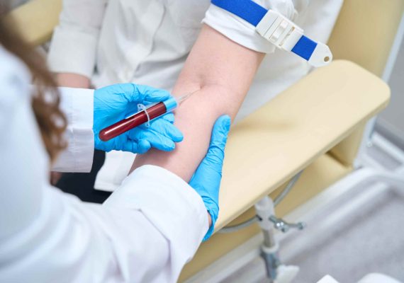 Metabolic blood tests - Aroga Pharmacy