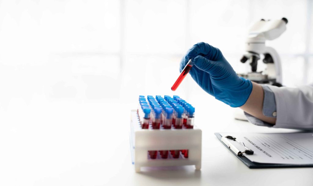 Infectious diseases blood test