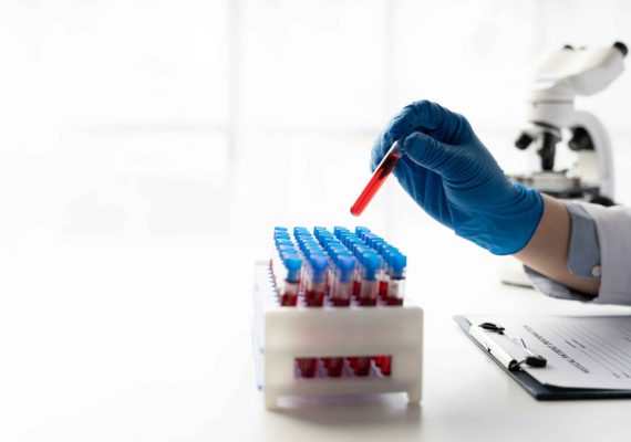 Infectious diseases blood test