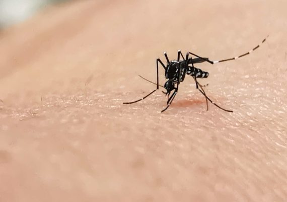 Malaria symptoms